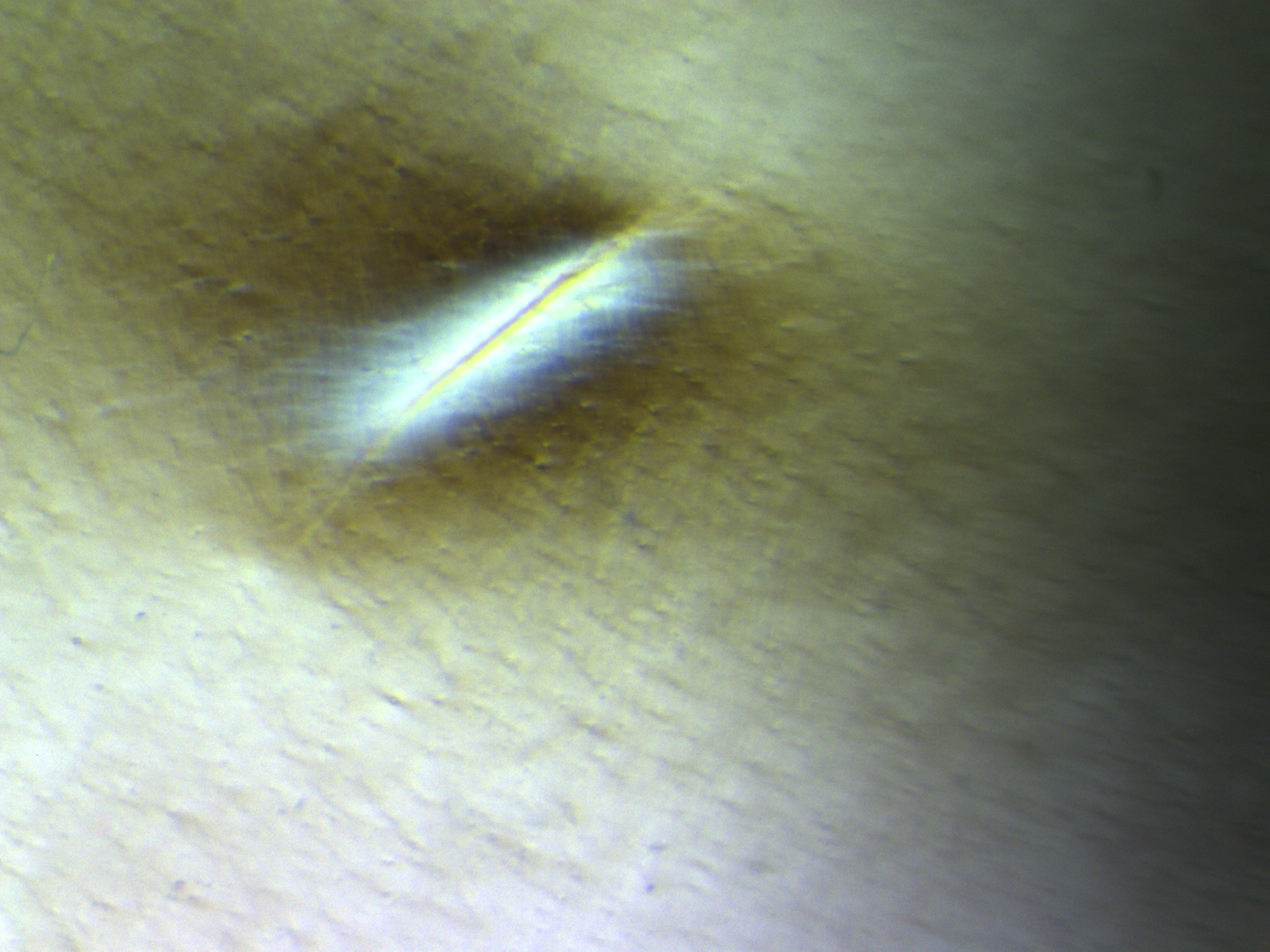 Balloon flaw under cross-polarized light at 0 degrees